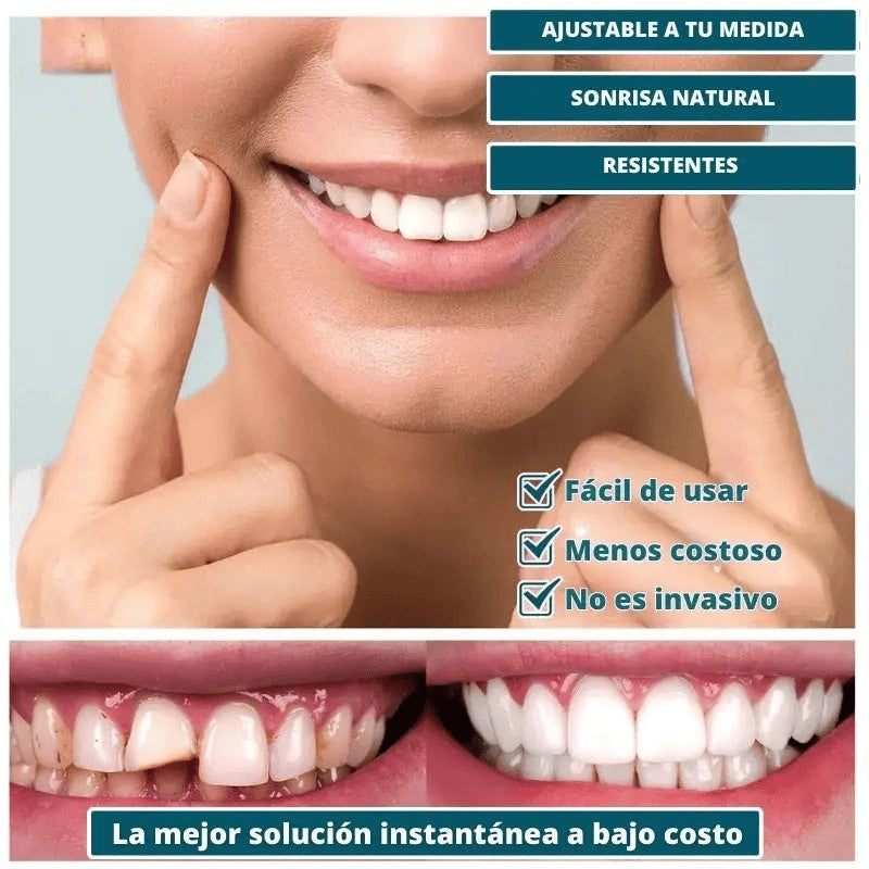 CARILLAS DENTALES SNAP ON DENTURE - CAMBIA TU VIDA Y TU SONRISA AL INSTANTE