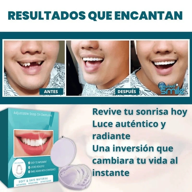 CARILLAS DENTALES SNAP ON DENTURE - CAMBIA TU VIDA Y TU SONRISA AL INSTANTE