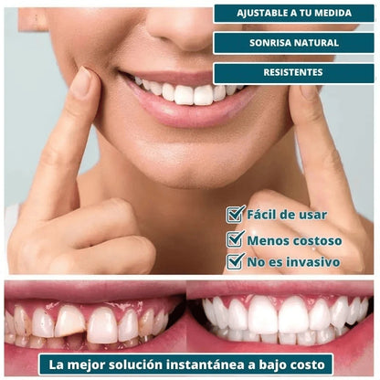 CARILLAS DENTALES SNAP ON DENTURE - CAMBIA TU VIDA Y TU SONRISA AL INSTANTE